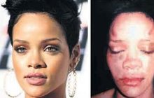 Zpěvačka Rihanna: Poprvé promluvila o tom, jak ji zmlátil přítel