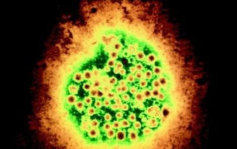 Takhle vypadá virus žloutenky.
