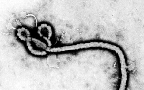Takto vypadá nebezpečný virus ebola.