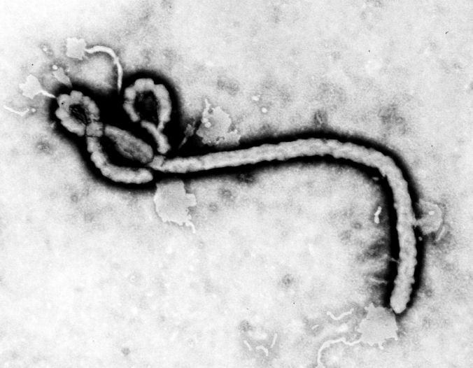 Takto vypadá nebezpečný virus ebola, který může učitelku zabít.