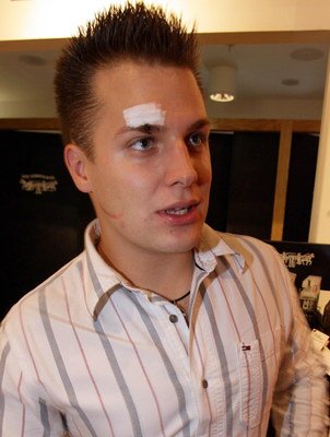 Tomáš Savka může být rád, že upadl tak šikovně, že si poranil jen obočí. Taky to mohlo odnést oko.