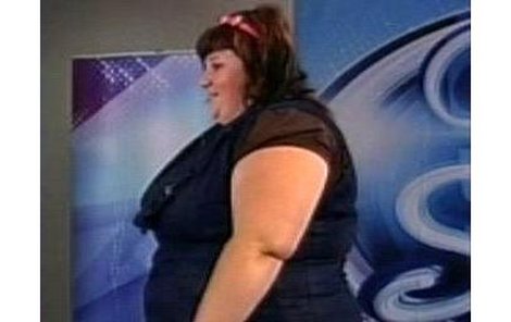 Za Radčinu obézní postavu prý mohou problémy se štítnou žlázou a metabolismem.