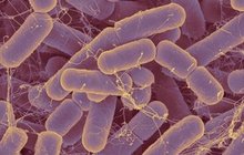 POZOR!: Míří k nám záhadná bakterie