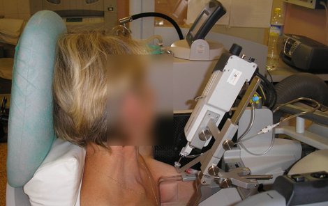Žena během odběru vzorku tkáně z prsu. 