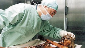 Pravěký muž Ötzi objevený v roce 1991 v alpském ledovci