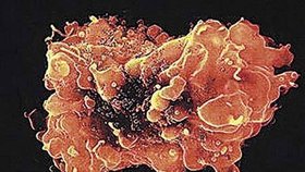 Buňka napadená virem HIV