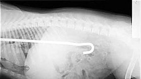 Rentgenový snímek ukázal stanový kolík v žaludku