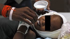 Holčička leží po znásilnění a pokusu o vraždu s vážnými zraněními v nemocnici. (Ilustrační foto)