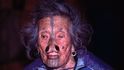 Ženy z kmene Apatani mají díry v nosech a tetování na obličeji.
