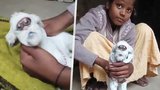 Bizarní rarita z Indie: Kůzle se narodilo s lidským obličejem!