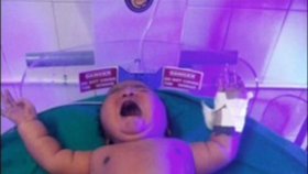 V Indii se narodil pořádný cvalík! Holčička po porodu navážila 6,8 kilogramu.