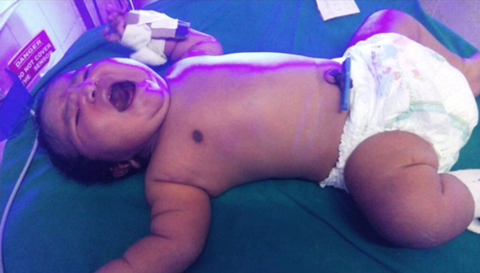 V Indii se narodil pořádný cvalík! Holčička po porodu navážila 6,8 kilogramu.
