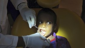 Indickému chlapci z pusy vyndali 526 zubů, trpěl zvláštní poruchou.