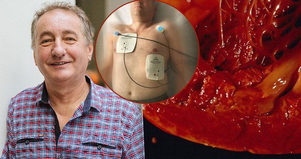 „Čekatel na infarkt“ Jiří (64): Nemoc srdce zabila celou jeho rodinu! Lékaři ho střeží...