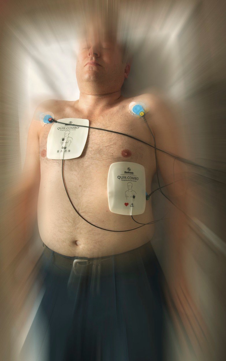 Pacient po srdeční příhodě (ilustrační foto)