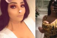 Influencerka chce vypadat jako Kim Kardashian: Utratila kvůli tomu přes 30 milionů!