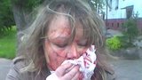 Pomsta exmilence: Ingrid nožem zohavil tvář! 