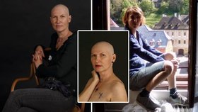 Ingrid (48) kvůli rakovině přišla o prsa: Odvážnými fotkami chce podpořit ženy se stejným osudem