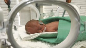 Patricie (19 dní): Zachránil ji nový inkubátor
