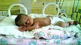Rodiče se soudí kvůli ochrnutí dcery: Miu (3) nakazily v inkubátoru špinavé ruce!