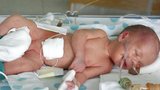 Zázračné miminko: Narodilo se bez krve!