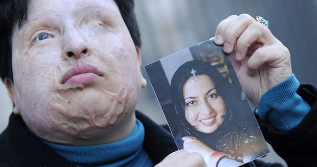 Íránka na poslední chvíli odpustila muži, který ji oslepil: Oči mu nevypálí