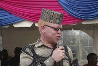„Sex s albínem HIV neléčí.“ První keňský poslanec-albín potírá pověry