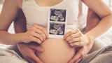 Odborník na neplodnost prozrazuje, jak úspěšně otěhotnět 