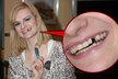 Blabá blondýna Iva Pazderková se nestydí ukázat ani díru v zubech