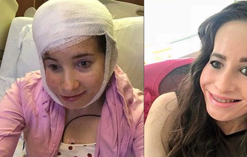 Ivanka bez poloviny obličeje podstoupila náročnou operaci. Konečně slyší na pravé ucho