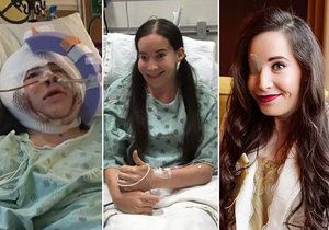 Ivana Danišová se narodila bez pravé půlky tváře, nyní ji čeká poslední operace.