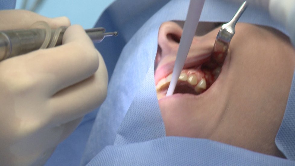 Iveta se podrobila bolestivé operaci. Lékaři jí museli rozřezávat dásně.
