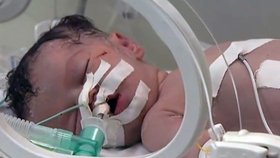 Dítě narozené z mrtvé maminky, kterou zasáhla rakety vystřelená Izraelem.