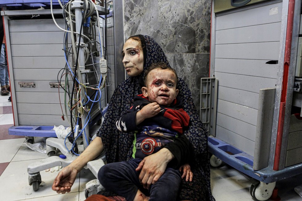 Zranění po úderu na nemocnici Al-Ahlí ve městě Gaza. (17.10.2023)
