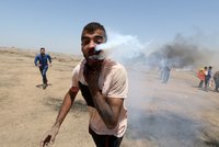 Hrůzné snímky: Granát slzného plynu trefil demonstranta přímo do obličeje
