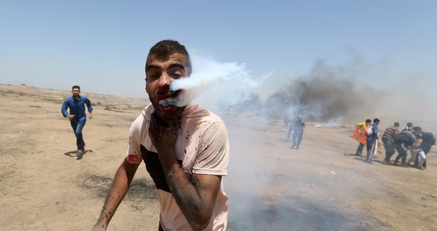 Hrůzné snímky: Granát slzného plynu trefil demonstranta přímo do obličeje