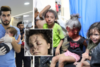 Šokující snímky z nemocnic v Pásmu Gazy: Zraněné děti čekají na ošetření, na ulici se hromadí těla