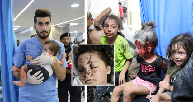 Šokující snímky z nemocnic v Pásmu Gazy: Zraněné děti čekají na ošetření, na ulici se hromadí těla