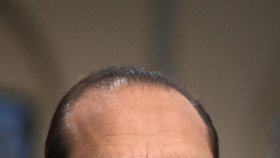 Francouzský exprezident Jacques Chirac