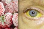 13 lidí onemocnělo ve Švédsku žloutenkou typu A po konzumaci mražených jahod.