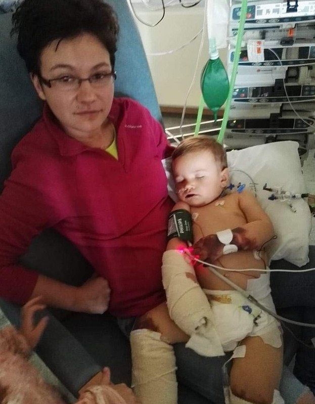 Jakub Kolek z Velké Británie přišel kvůli sepsi o šest prstů na rukou a všechny na chodidlech. Rodina prosí o pomoc při sbírce na drahou operaci.