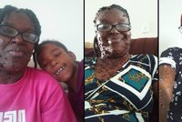 Máma má kůži od hlavy k patám pokrytou malými nádory: Kvůli nemoci ji vyhodili z práce