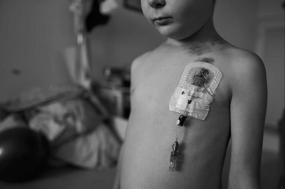 Malý syn herce Jana Dobríka se léčí s leukémií.