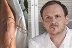 Nová tvář Ordinace Jan Hájek: Seriál mu zachránil nohu, hrozila amputace!