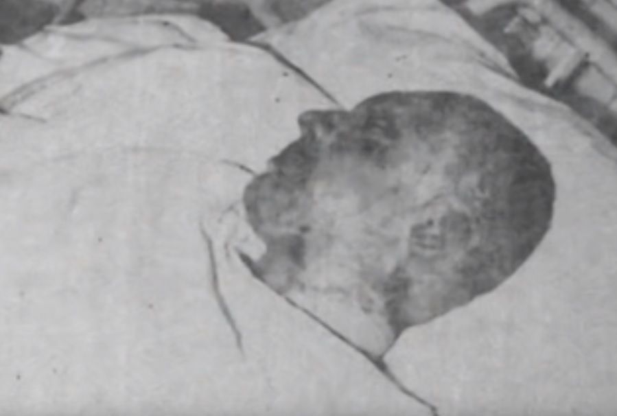 Trpící Palach v nemocnici: smutný snímek z tajně pořízeného videa.