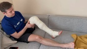 Místopředseda Sněmovny Jan Skopeček (ODS) po operaci.