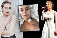 Patrícia Janečková (24) bojující s rakovinou: Vážná operace! Přiznala obavy