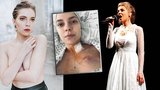 Patrícia Janečková (24) bojující s rakovinou: Vážná operace! Přiznala obavy