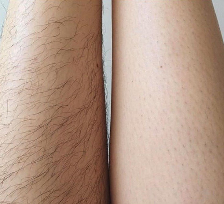 Januhairy