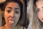 Jaqueline Alarcãová tvrdila, že jí zuby spravil manžel zubař.